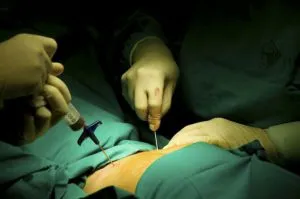 Analiza biopsii pentru care