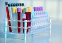 Imunitatea celulară că vitaportal - Sănătate și Medicină