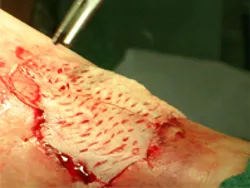 Clinica chirurgie inovatoare - tehnologii moderne de chirurgie vasculară