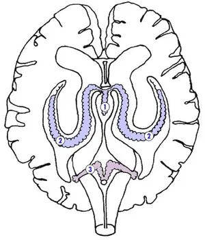 Chist plex vascular al creierului Cauzele nou-nascuti si tratament (creier) Chist plexul vascular al creierului cauzelor nou-născuți și tratamentul