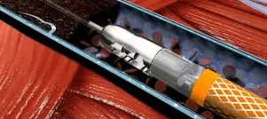 Clinica chirurgie inovatoare - tehnologii moderne de chirurgie vasculară