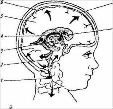 Chist plex vascular al creierului Cauzele nou-nascuti si tratament (chist) Chist plexul vascular al creierului cauzelor nou-născuți și tratamentul