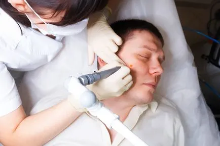 Spitalul în moli de îndepărtare Moscova (clinica birthmarks Moscova) Spitalul în moli de îndepărtare Moscova