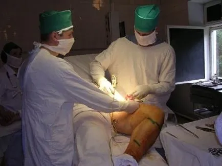Clinica de Chirurgie Vasculara