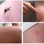 Cine poate musca pe timp de noapte în pat, cu excepția erorilor (cu excepția) Cine poate musca pe timp de noapte în pat, cu excepția ploșnițe