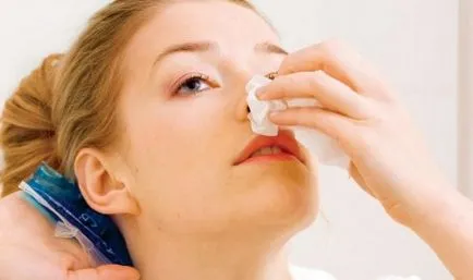 Sangerarea din nas cum să oprească cauzele de epistaxis la adulți (stop) Sangerarea din nas cum să oprească cauzele de epistaxis la adulți