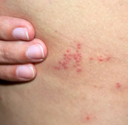 Biter în pat noaptea, când nimeni nu poate vedea (musca pat timp de noapte) Biter în pat noaptea, când nimeni nu la vedere