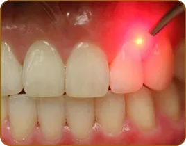 Stomatologie cu laser la Moscova