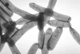 Legionella ucigaș în sistemele de apă (Legionella) Killer Legionella în sistemele de apă