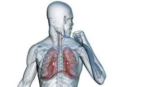 remedii de tratament traheită populare (mijloace) Tratamentul de remedii populare traheită