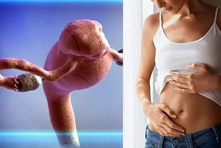 Tratamentul pe bază de plante de fibrom uterin, medicina populara pentru fibrom, rețete