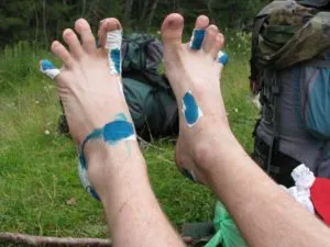 blister izbucni pe piciorul ce să facă și cum să trateze