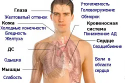 Radioterapia in oncologie, tipurile și consecințele acesteia (video) (radiații) Radioterapia in oncologie, tipurile și consecințele sale (video)