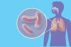 Radioterapia in oncologie, tipurile și consecințele acesteia (video) (Oncologie) Radioterapia in oncologie, tipurile și consecințele sale (video)