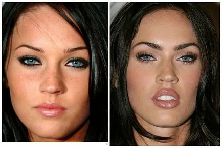 Megan fox, înainte și după fotografii și video de chirurgie plastica