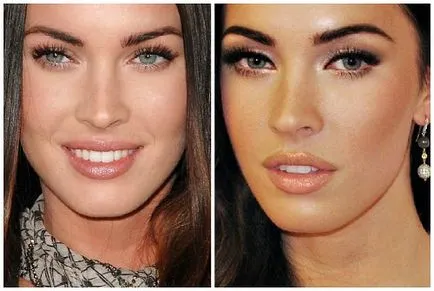Megan fox, înainte și după fotografii și video de chirurgie plastica
