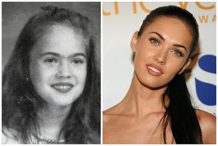 Megan fox, înainte și după fotografii și video de chirurgie plastica