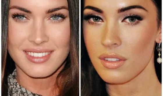 Megan fox, înainte și după fotografii și video de chirurgie plastica