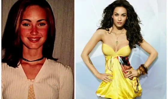 Megan fox, înainte și după fotografii și video de chirurgie plastica