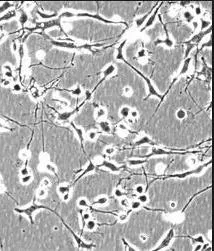 cerebel cerebral