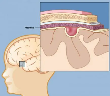 neurosonography nou-născut ce este, rata și decodare (nou-nascuti) neurosonography nou-născut ce este, iar rata de transcriere