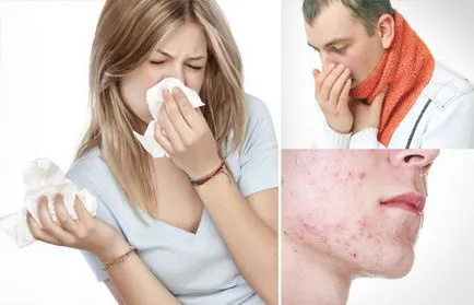 Cauzele Red Nose, leacurile tratament popular (ca leac) nas roșu cauze, tratamentul de remedii populare