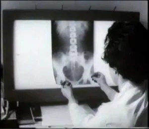 Review, urografie excretor renală și contrast intravenos mediu cu copii și (Review) Opinie, urografie excretor renală și mediu de contrast intravenos cu copii și