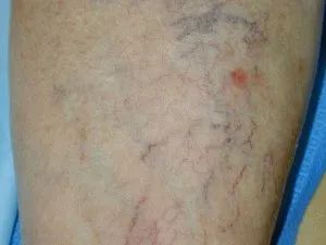 Principalele cauze ale durerii în mușchii picioarelor (Astfel de display-uri au nevoie) Principalele cauze ale durerii în mușchii picioarelor