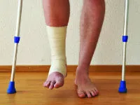Fractura a tibiei cu deplasare și fără (deschis, închis) și primul ajutor