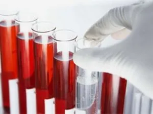 Primele simptome de prostatita - ce să facă atunci când apar (mai întâi) Primele simptome de prostatita - ce să facă atunci când acestea apar;