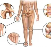 Portal pentru Traumatologie și Ortopedie