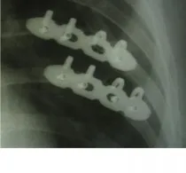 Portal pentru Traumatologie și Ortopedie