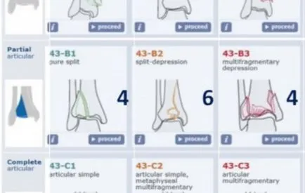 Portal pentru Traumatologie și Ortopedie