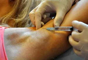 transpirație Underarm