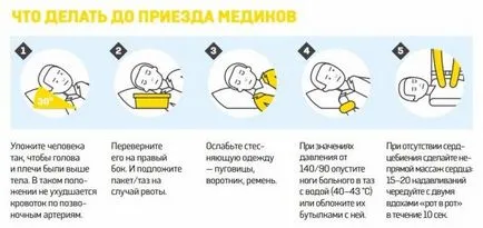 Context și prevestitori de un accident vascular cerebral creierului la femei și bărbați