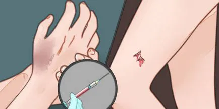 Vaccinarea împotriva tetanosului pentru adulți atunci când o fac, efecte secundare, tipuri de vaccinuri