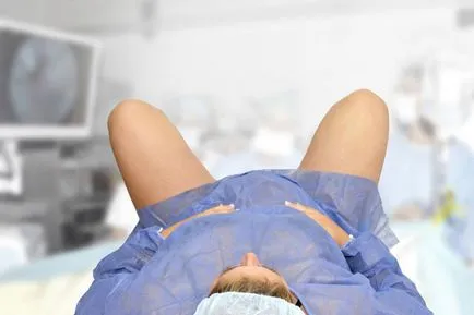 Puncție vezicii urinare înainte de naștere indicații și contraindicații ale tehnicii, senzație (Conception) Puncție vezicii urinare înainte de naștere indicații și contraindicații ale tehnicii, sentimentul