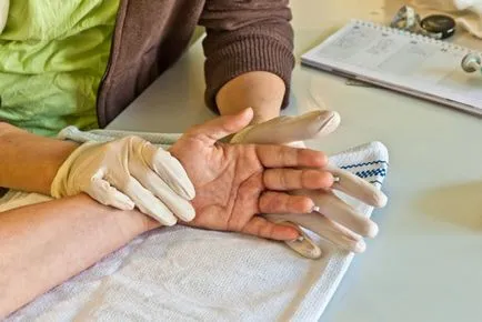 Reabilitare după accident vascular cerebral, atât recuperarea preparate cât mai mare (reabilitare) Reabilitarea dupa un atac vascular cerebral pentru a recupera, medicație, calendarul