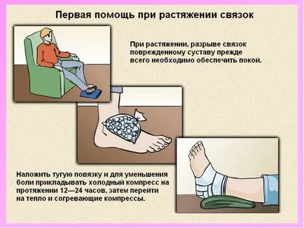 Tratamentul entorsa la domiciliu, medicamente tradiționale eficiente și unguente pentru (home) Tratamentul entorsa la domiciliu, medicamente tradiționale eficiente și unguente la