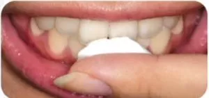 Remineralizantă dintilor mousse gc gel dinte (mousse myc) instrucțiuni, feedback-ul (mousse dinte) Remineralizantă gel gc dinte dinti mousse (myc mousse) comentarii instruire