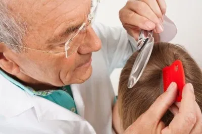 Solzos, râios scalp de un adult, un copil ce să facă, motivele