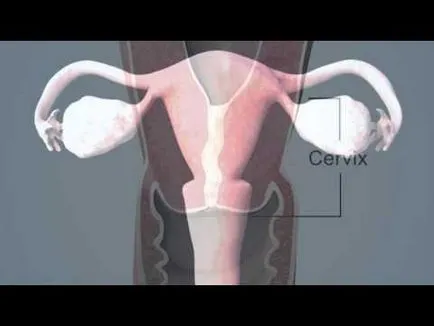 Colului uterin înainte de menstruație la atingere, arata ca si cum ar trebui să fie (gât) Colului uterin înainte de menstruație la atingere, arata ca și ceea ce ar trebui să fie