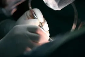 Simptomele, prevenirea și tratamentul abdominale anevrism aortic în