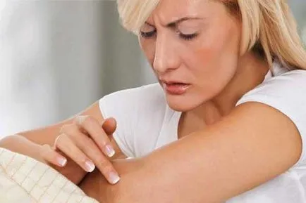 lupus sistemic eritematos tratament și simptome (simptome) Tratamentul sistemic eritematos lupus și simptome