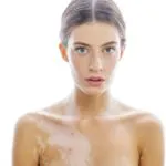 Cum imposibil și atunci când se poate face plajă după îndepărtarea mol (plajă) Cum imposibil și atunci când se poate face plajă după îndepărtarea birthmarks
