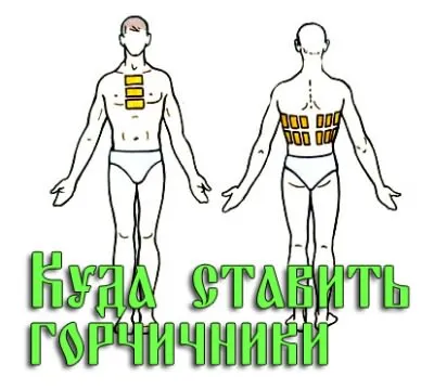 Cât de mulți sunt în spital cu pneumonie (minciuna) Cât de mulți sunt în spital cu pneumonie