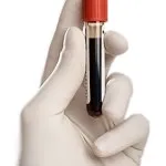 Ce este un diagnostic rapid