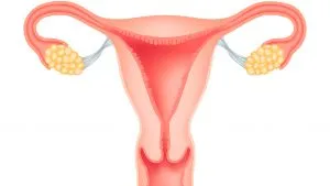 Uzi endometrioza