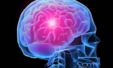 La un an dupa accident vascular cerebral