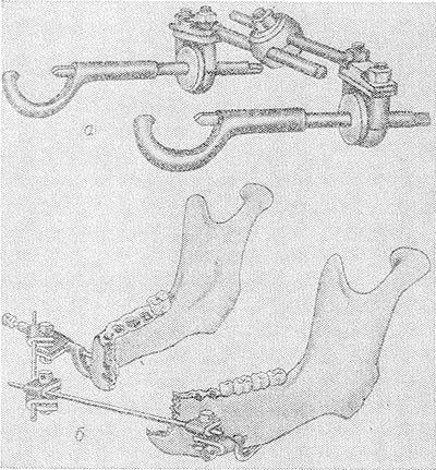 Echipament stomatologic